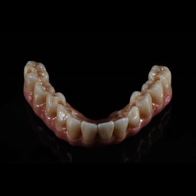 kualitas  Fixed Restorations Full Arch Zirconia Implant Bridge Denture Teeth pabrik