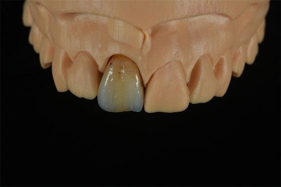 kualitas  Affordable Zirconia Crowns with Custom Color Staining - China Dental Lab pabrik